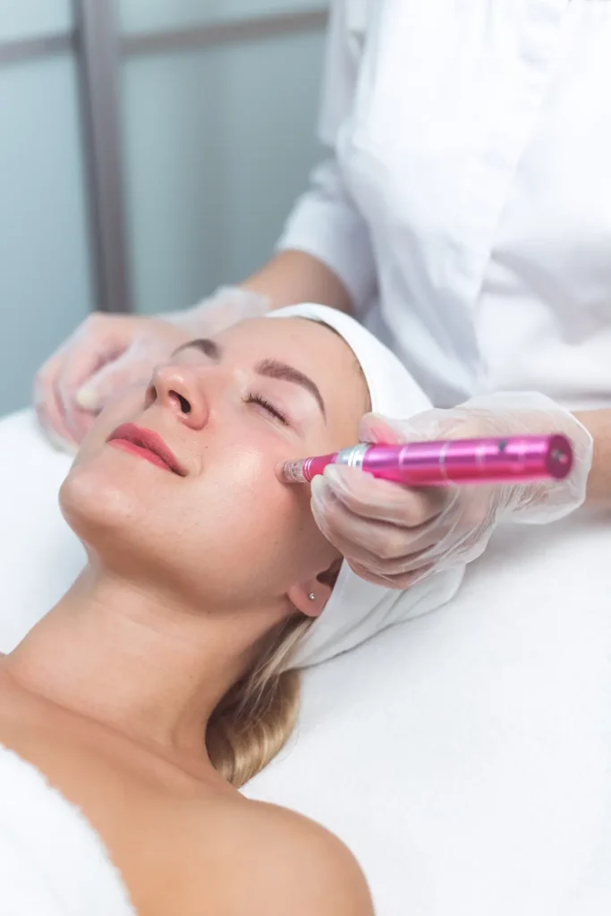 Women receiving medical grade microneedling service in a spa setting